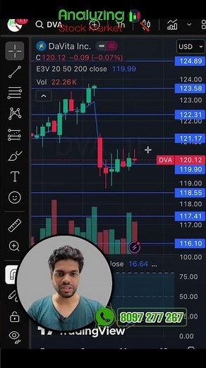 Davita target 11 November 2025 | Davita Share News | Stock Analysis | S&P 500 today