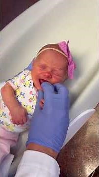 Frenectomy Stretches