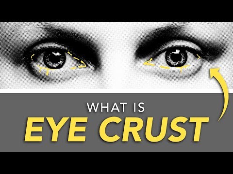 Why Are My Eyes Crusty?