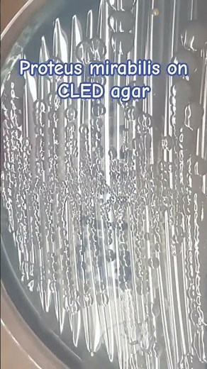 Colony Morphology of Proteus mirabilis on CLED Agar: Diagnostic Features and Clinical Significance