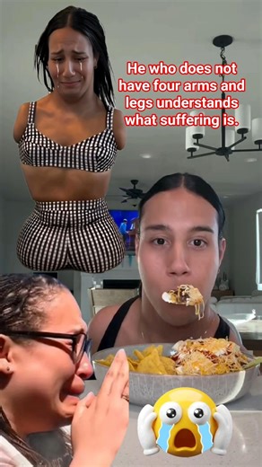 He who does not have four arms and legs understands what suffering is #viralvideo #shorts #emotional