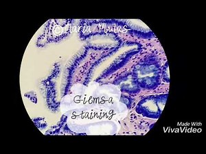 Giemsa staining of stomach biopsy
