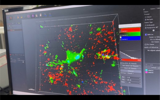 小胶质细胞吞噬分析2（Imaris分析过程）｜同门美女教学