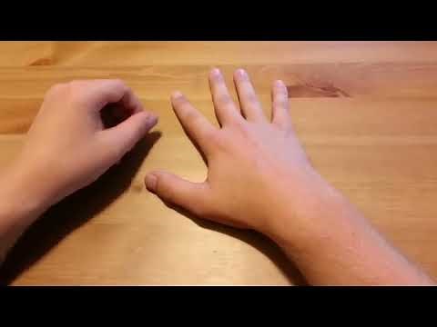 Heberden's and Bouchard's nodes