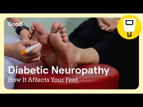 Diabetic Neuropathy: How It Affects Your Feet | GoodRx