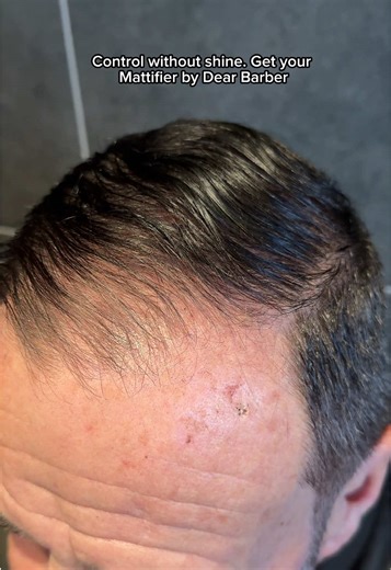 Thin hair AND oily roots? We got you! 👋 Dear Barber Mattifier keeps shine under control while adding light, clean volume that lasts. No grease, no heaviness, just fresh, matte texture all day. Shop now on TikTok Shop! #OilyHairFix #Mattifier #RootRefresh #fypge #thinninghair