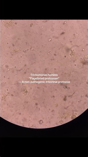 Trichomonas hominis 💩 #badbunny #medical #medtech #laboratory #fecalysis #musica