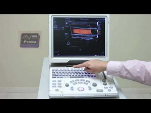 MINDRAY | Mindray Z6 Tutorial Spainish Portable Color Doppler Diagnostic Ultrasound System