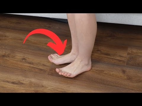 Stop SWOLLEN LEGS in 5 Minutes! 🦵✨ (Easy Exercises)