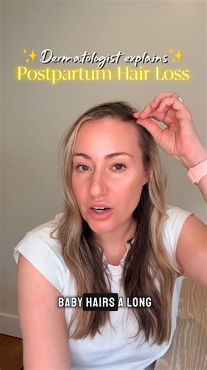 Joan Leavens, MD | Medical and Aesthetic Dermatology on Instagram: "✨Postpartum hair loss almost always = telogen effluvium✨ This is an extremely common (and very temporary) shift of hairs into the shedding phase after delivery. • Onset: ~3 months postpartum • Peak: fast + dramatic (the shower-drain moment 👀) • Duration: active shedding phase lasts about 3-6 months • Regrowth: expected with full recovery. Signs of recovery can include wisps of baby hairs at the frontal hairline (wings!) • Treat