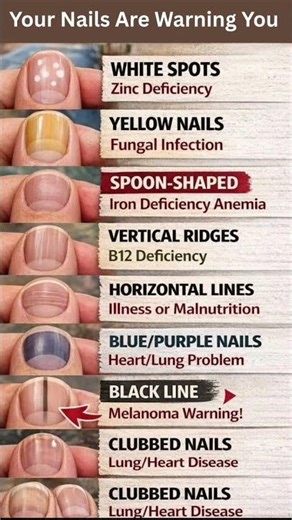 Body Warning Signs Hidden in Your Nails #facts #health