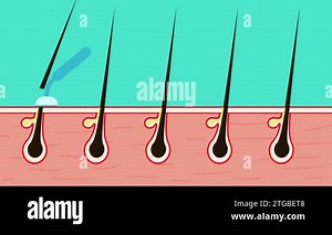 Shaving body hair with a shaver blade 4K animation. Hair removal concept with a shaver and showing effect inside the skin. Cutting skin hair with a razor blade and inside skin information animation Stock Video Footage - Alamy