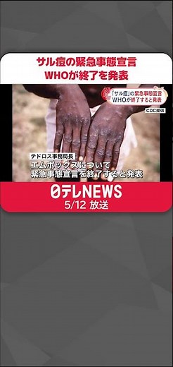 【サル痘の緊急事態宣言】WHOが終了を発表 #shorts