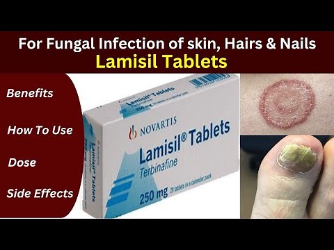Lamisil tablets how to use | Terbinafine | toenail fungus | Fungal infection best medicine