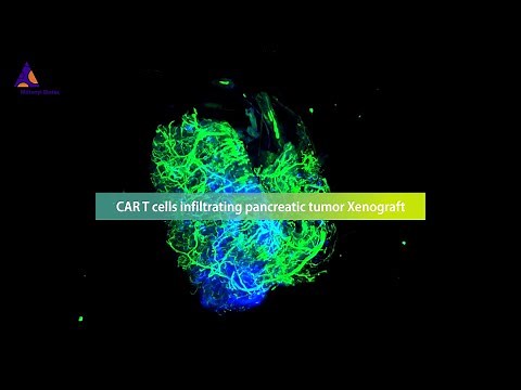 Revolutionizing the monitoring of CAR T cell therapies against solid tumors with the 3D imaging