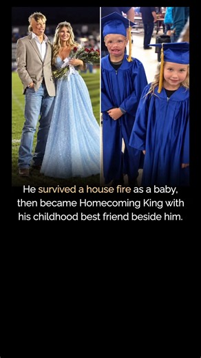He Survived a House Fire as a Baby—Years Later, He Became Homecoming King