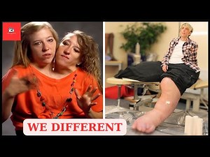 12 Unique People You Won't Believe Actually Exist | Then and Now 2025