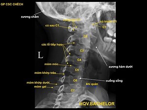 X quang CSC chếch (Giải phẫu cột sống cổ)
