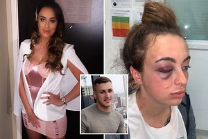 My angry ex throttled me until I blacked out & shoved his fist down my throat after I was late home after night out