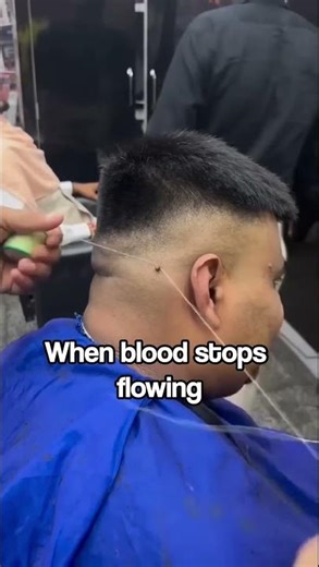 This “Easy” Wart Removal Trick Has a Dark Side.