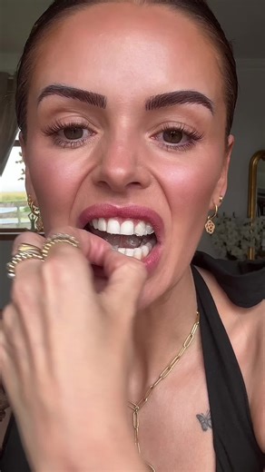 Brighter Smiles with Gentle Whitening Solutions