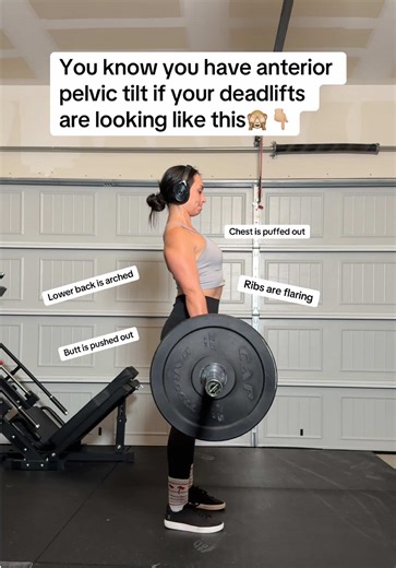 Understanding Anterior Pelvic Tilt and Its Impact on Movement