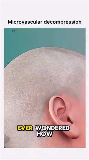 Animations on Instagram: "Follow @surgicalanimation for more! 🏥"