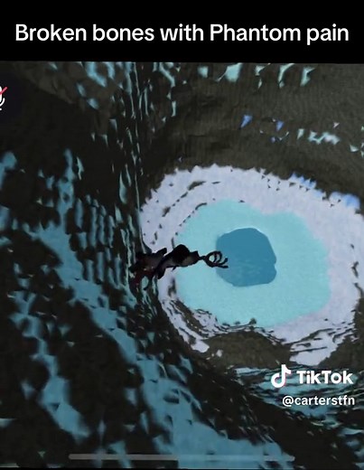 Roblox Gameplay: Conquering Broken Bones with Phantom Pain