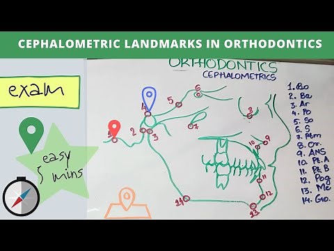 cephalometric landmarks in orthodontics