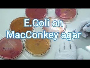 Enumeration of Escherichia coli (Total E. coli Count)|Escherichia Coli (E. Coli) on macconkey agar
