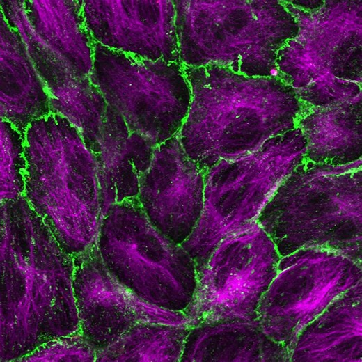 New ultrasound imaging to map drug delivery into the brain