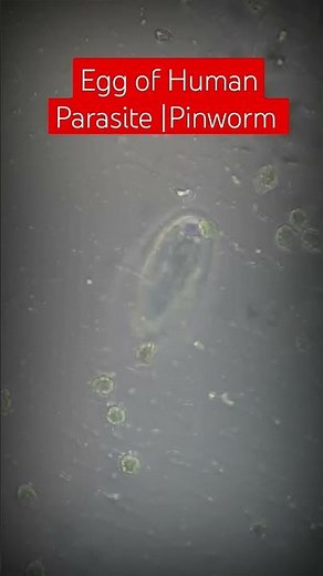 Egg of Human Parasite |Pinworm |Enterobius vermicularis