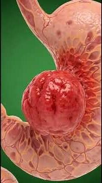 “Maize Inside the Human Body: 3D Medical Animation of Benefits & Effects”#Anatomy3D #HealthExplained