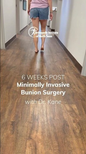 Just 6 weeks after minimally invasive bunion surgery with Dr. Kane at OINT. #BunionSurgery