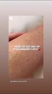 #IPL #hairremovaltreatment #homeuse | Zeeman's