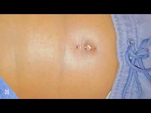NAVEL PIERCING
