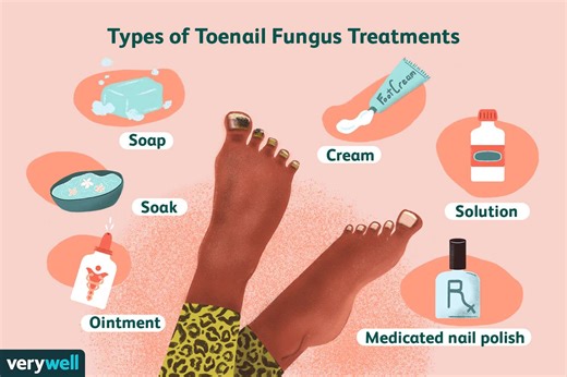 toenail fungus causes prevention and treatment options