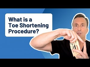 What Is a Toe Shortening Procedure? How Do I Fix My Long Toe??