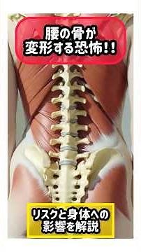 腰の骨が変形する恐怖！変形性腰椎症の原因と隠れたリスクとは…