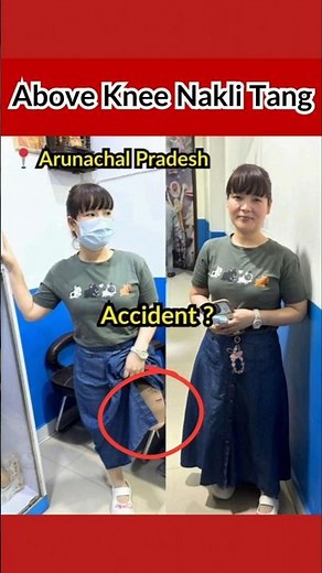 Above Knee Nakli Tang #prostheticlimb #bornlife #artificialleg #artificiallimb #foryou #prosthesis