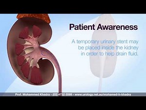 Pyeloscopy - Professor Mohamed H Khadra
