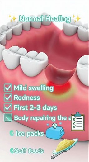 🦷 Swollen Gums After a Tooth Extraction? This Is Often Normal.