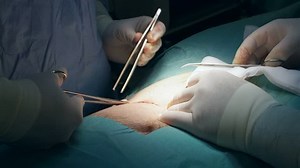 clip-1013189054-doctors-performing-surgery-operating-room