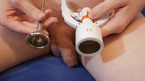 Chinese DIY ZSR Stapler Circumcision