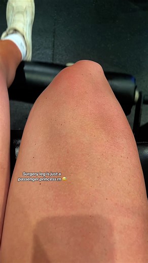 Princess on the Path to Recovery: ACL Surgery Journey