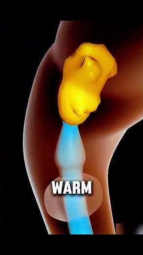 How Enema Therapy Actually Works | Safe Colon Cleanse Explained Step-by-Step #facts