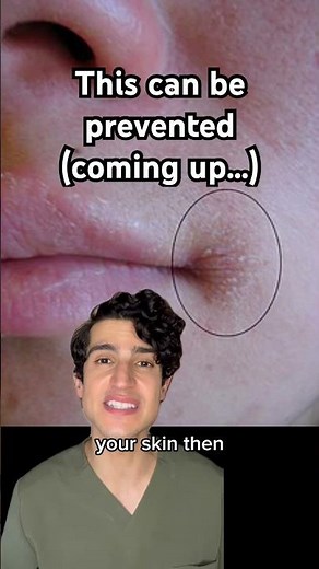 Dermatologist explains why your skin is so dry around the mouth! #dryskin #flakyskin #dermatologist