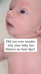 24K views · 22 reactions | Lip blisters are a clue. What happens...