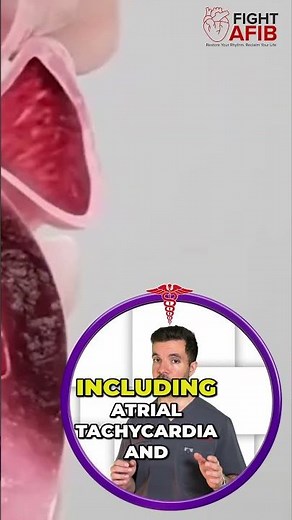 What Doctors Won't Tell You About AFib Ablations