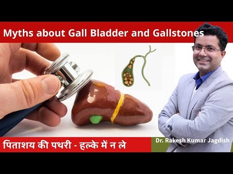 Preventing Gallstones formation and Cholelithiasis | How to avoid Gallstones | Dr Rakesh Kumar drrkj